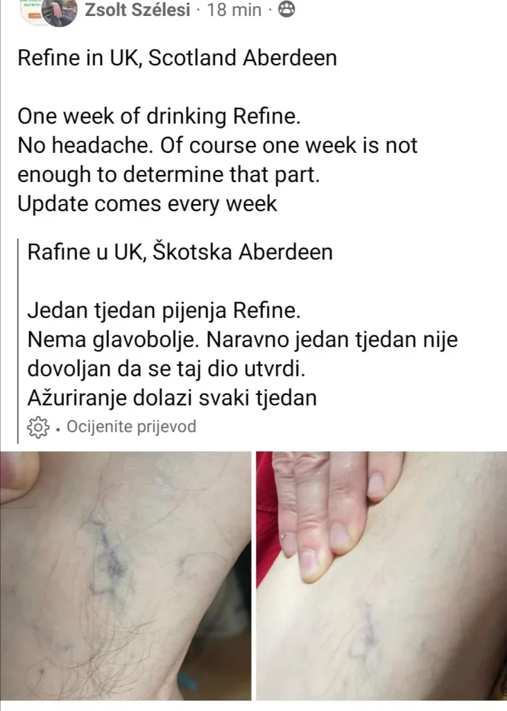 Iskustva korisnika sa prirodnim NHG Refine kapima