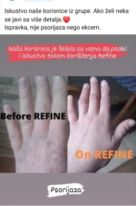 Recenzije i iskustva korisnika sa NHG Refine kapima za svakodnevni balans