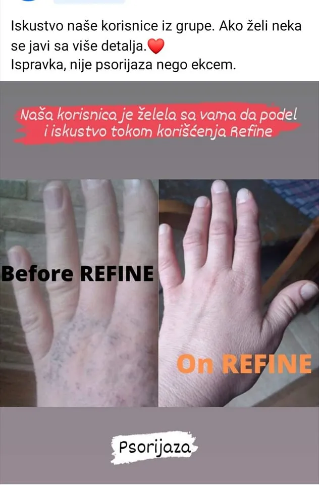 Recenzije i iskustva korisnika sa NHG Refine kapima za svakodnevni balans
